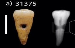 Новости из Турции - Ювелирные изделия из зубов людей найдены в Турции